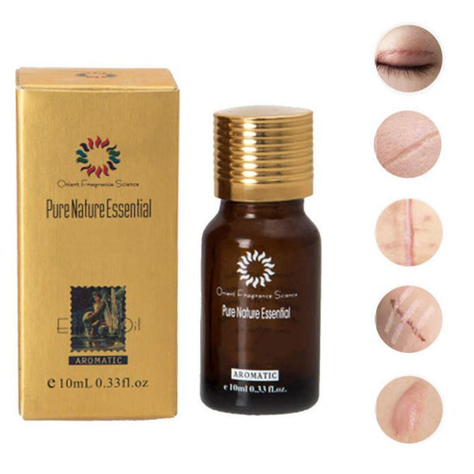 Natural Removal Acne Stretch Marks Scar oil